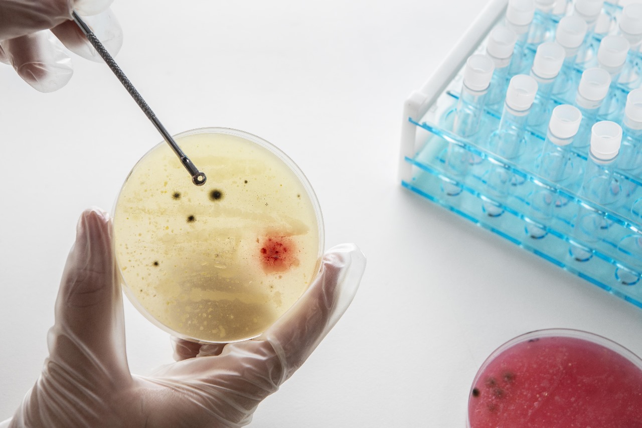 Taller Transformación Bacteriana